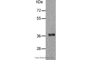 Western blot analysis of Human fetal muscle tissue, using PARD6A Polyclonal Antibody at dilution of 1:650 (PARD6A Antikörper)