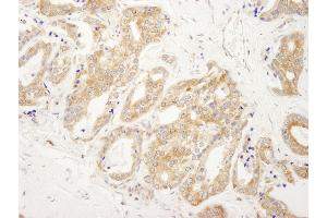 Immunohistochemistry (IHC) image for anti-DEAD (Asp-Glu-Ala-Asp) Box Polypeptide 6 (DDX6) (AA 1-50) antibody (ABIN7448524)