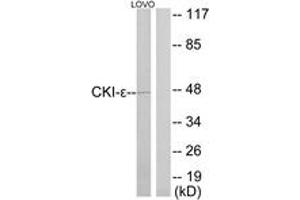 Western blot analysis of extracts from LOVO cells, using CKI-epsilon Antibody. (CK1 epsilon Antikörper  (AA 276-325))