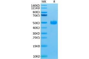 Biotinylated Human SIRP gamma on Tris-Bis PAGE under reduced condition. (SIRPG Protein (AA 29-360) (His-Avi Tag,Biotin))