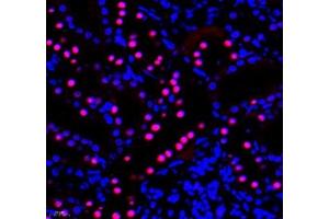 Immunofluorescence of paraffin embedded rat kidney using PRPF3 (ABIN7075311) at dilution of 1: 2200 (400x lens) (PRPF3 Antikörper)