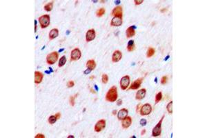 Immunohistochemical analysis of Neurotrimin staining in human brain formalin fixed paraffin embedded tissue section. (Neurotrimin Antikörper  (C-Term))