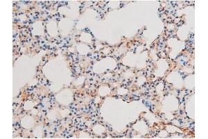 ABIN6267601 at 1/200 staining Mouse lung tissue sections by IHC-P. (NF-kB p65 Antikörper  (pThr435))