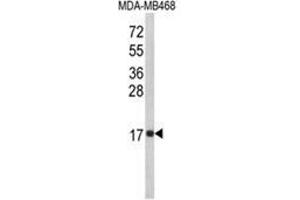 Western blot analysis of IL8 Antibody (C-term) in MDA-MB468 cell line lysates (35ug/lane). (IL-8 Antikörper  (C-Term))