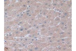 IHC-P analysis of Human Kidney Tissue, with DAB staining. (NOTCH4 Antikörper  (AA 1715-2001))