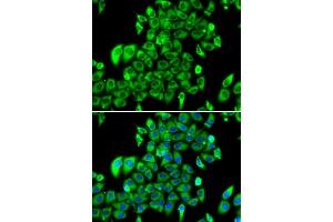 Immunofluorescence analysis of MCF-7 cells using RPL13 antibody. (RPL13 Antikörper  (AA 1-211))