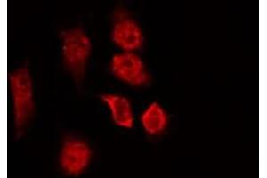 ABIN6266914 staining NIH-3T3 by IF/ICC. (CCDC99 Antikörper  (C-Term))