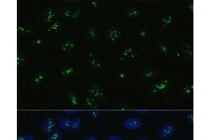 Immunofluorescence analysis of U-2 OS cells using NOLC1 Polyclonal Antibody at dilution of 1:100. (NOLC1 Antikörper)