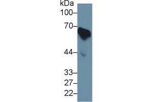 Western Blot; Sample: Human Serum; Primary Ab: 1µg/ml Rabbit Anti-Human CDC25B Antibody Second Ab: 0. (CDC25B Antikörper  (AA 377-566))