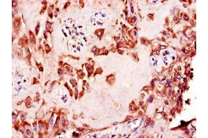 Immunohistochemistry of paraffin-embedded human placenta tissue using ABIN7156151 at dilution of 1:100 (NAALADL2 Antikörper  (AA 143-795))