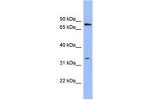 Image no. 1 for anti-Zinc Finger Protein 278 (ZNF278) (AA 35-84) antibody (ABIN6741631) (PATZ1 Antikörper  (AA 35-84))