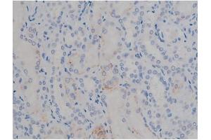 ABIN6267355 at 1/200 staining Human kidney tissue sections by IHC-P. (MAPT Antikörper  (pSer356))