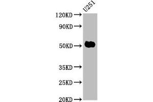 Western Blot Positive WB detected in: U251 whole cell lysate All lanes: FEZF1 antibody at 6 μg/mL Secondary Goat polyclonal to rabbit IgG at 1/50000 dilution Predicted band size: 53, 47, 52 kDa Observed band size: 53 kDa (FEZF1 Antikörper  (AA 1-115))