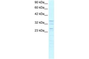 Western Blotting (WB) image for anti-Zinc Finger Protein 385A (ZNF385A) antibody (ABIN2460293)