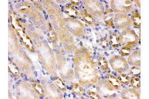 Alpha Actinin 4 was detected in paraffin-embedded sections of mouse kidney tissues using rabbit anti- Alpha Actinin 4 Antigen Affinity purified polyclonal antibody (Catalog # ) at 1 µg/mL. (alpha Actinin 4 Antikörper  (AA 561-661))