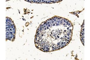 ABIN7096323 and ABIN7100385 at 1/100 staining mouse testis tissue by IHC-P. (PHF16 Antikörper)