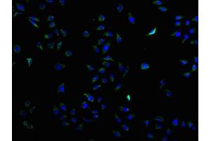 Immunofluorescence (IF) image for anti-CD9 (CD9) (AA 112-195) antibody (ABIN7147203)