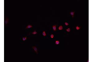 ABIN6268887 staining HeLa cells by IF/ICC. (PRKDC Antikörper  (C-Term))