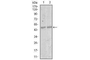 Image no. 1 for anti-Myocyte Enhancer Factor 2C (MEF2C) antibody (ABIN1490566) (MEF2C Antikörper)