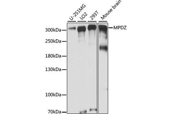 MPDZ Antikörper  (AA 1100-1380)