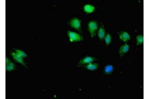 Immunofluorescent analysis of A549 cells using ABIN7156261 at dilution of 1:100 and Alexa Fluor 488-congugated AffiniPure Goat Anti-Rabbit IgG(H+L) (IKBKB Antikörper  (AA 395-588))