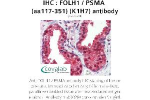 Image no. 2 for anti-Folate Hydrolase (Prostate-Specific Membrane Antigen) 1 (FOLH1) (AA 117-351) antibody (ABIN1723210) (PSMA Antikörper  (AA 117-351))
