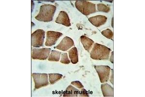 Formalin-fixed and raffin-embedded human skeletal muscle reacted with DI Antibody (Center), which was peroxidase-conjugated to the secondary antibody, followed by DAB staining. (CCDC85B Antikörper  (AA 69-96))