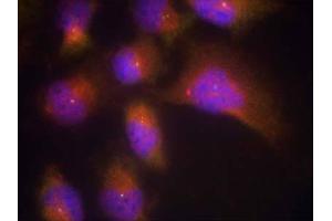 Immunofluorescence staining of methanol-fixed HeLa cells using TrkB (Phospho-Tyr515) Antibody (E011327, Red) (TRKB Antikörper  (pTyr515))
