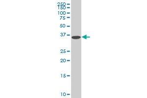 Western Blotting (WB) image for anti-Decapping Enzyme, Scavenger (DCPS) (AA 1-338) antibody (ABIN599227) (DCPS Antikörper  (AA 1-338))