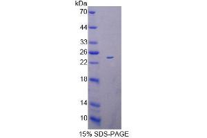 SDS-PAGE (SDS) image for Acyl-CoA Dehydrogenase, C-2 To C-3 Short Chain (Acads) (AA 210-397) protein (His tag) (ABIN6239322) (ACADS Protein (AA 210-397) (His tag))