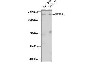 Western blot analysis of extracts of various cell lines, using IFN Rabbit mAb (ABIN1682980, ABIN3015227, ABIN3015228 and ABIN7101324) at 1:1000 dilution. (IFNAR1 Antikörper)