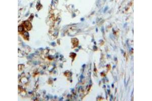 IHC-P analysis of Lung tissue, with DAB staining. (Surfactant Protein C Antikörper  (AA 24-197))