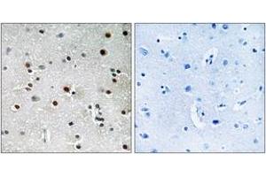 Immunohistochemistry analysis of paraffin-embedded human brain tissue, using RFX3 Antibody. (RFX3 Antikörper  (AA 641-690))