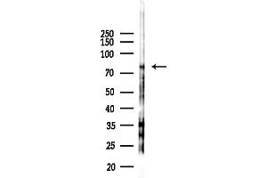 anti-Catenin (Cadherin-Associated Protein), alpha-Like 1 (CTNNAL1) (Internal Region) antibody