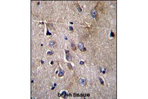 Immunohistochemistry (Paraffin-embedded Sections) (IHC (p)) image for anti-Nuclear Factor of kappa Light Polypeptide Gene Enhancer in B-Cells Inhibitor-Like 1 (NFKBIL1) (AA 327-356), (C-Term) antibody (ABIN656729)