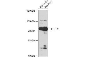 Western blot analysis of extracts of various cell lines, using KLHL11 antibody (ABIN7268078) at 1:1000 dilution. (KLHL11 Antikörper  (AA 16-300))