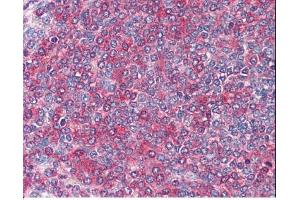 Image no. 1 for anti-Frizzled Family Receptor 7 (FZD7) (C-Term) antibody (ABIN374921) (FZD7 Antikörper  (C-Term))