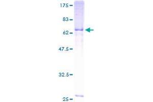 Image no. 1 for Neutral Cholesterol Ester Hydrolase 1 (NCEH1) (AA 1-408) protein (GST tag) (ABIN1305388) (NCEH1 Protein (AA 1-408) (GST tag))