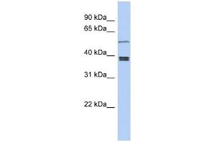 SS18L1 antibody used at 1 ug/ml to detect target protein. (SS18L1 Antikörper  (Middle Region))