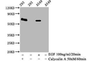 Western Blot Positive WB detected in 293 whole cell lysate 65549 whole cell lysate(treated with Calyculin A or EGF) All lanes Phospho-PRKAA2 antibody at 1. (Rekombinanter PRKAA2 Antikörper  (pThr172))