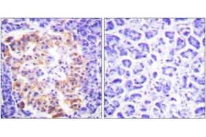 Immunohistochemistry analysis of paraffin-embedded human pancreas tissue, using Collagen III Antibody. (COL3 Antikörper  (AA 81-130))