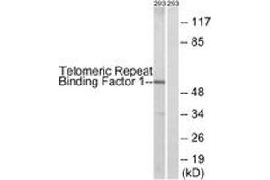 Western blot analysis of extracts from 293 cells, treated with Paclitaxel 1uM 24h, using Telomeric Repeat Binding Factor 1 (Ab-219) Antibody. (TRF1 Antikörper  (AA 185-234))