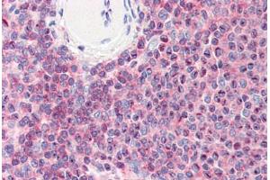 Human Spleen (formalin-fixed, paraffin-embedded) stained with CFL1 antibody ABIN364365 at 10 ug/ml followed by biotinylated anti-mouse IgG secondary antibody ABIN481714, alkaline phosphatase-streptavidin and chromogen.