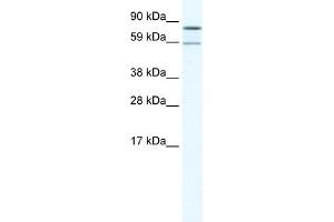 WB Suggested Anti-PARN Antibody Titration:  1. (PARN Antikörper  (N-Term))