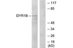 Western blot analysis of extracts from Jurkat cells, using DYR1B Antibody.