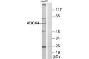 Western blot analysis of extracts from HepG2 cells, using ADCK4 Antibody.