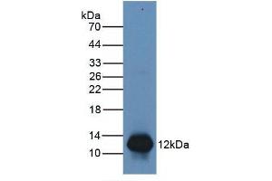 Figure. (S100A8 Antikörper  (AA 1-93))