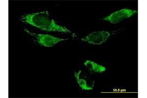 Immunofluorescence (IF) image for anti-ATPase Family, AAA Domain Containing 3B (ATAD3B) (AA 1-648) antibody (ABIN529516)