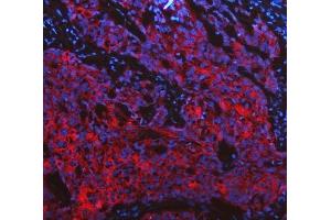 IF analysis of Cytokeratin 19 using anti-Cytokeratin 19 antibody (ABIN3043288).