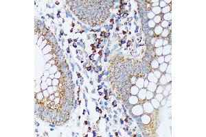 Immunohistochemistry of paraffin-embedded human appendix using Sprouty 2 Rabbit mAb (ABIN7270554) at dilution of 1:100 (40x lens).